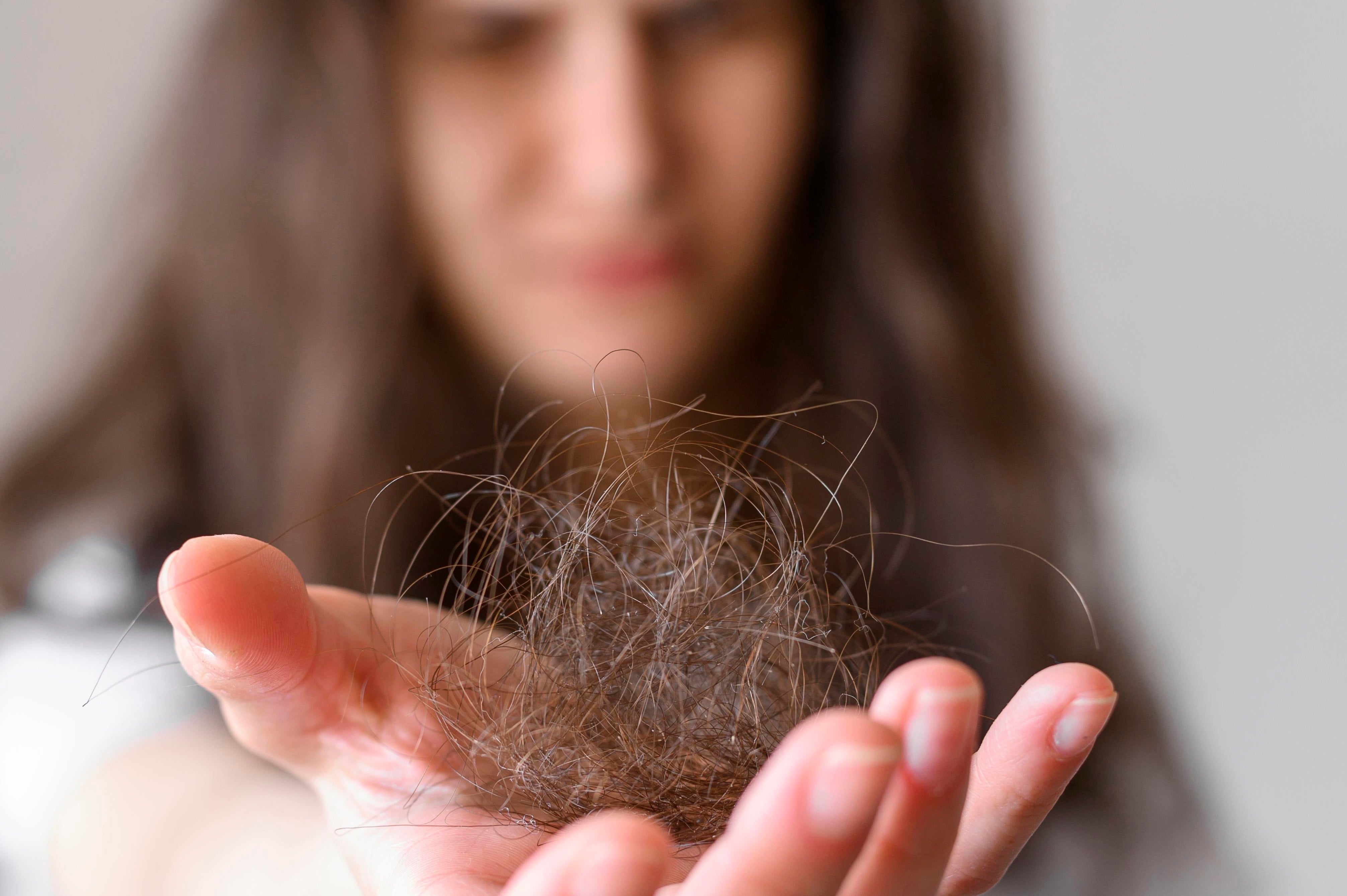 Descubra Agora: Como os Produtos Naturais Podem Combater a Queda de Cabelo